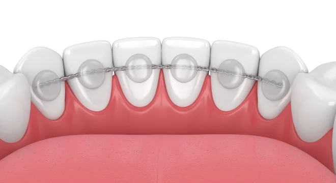 Retainer fixed 2col content img