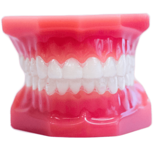 Invisalign