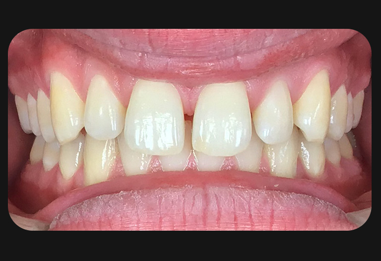 Ks intraoral before